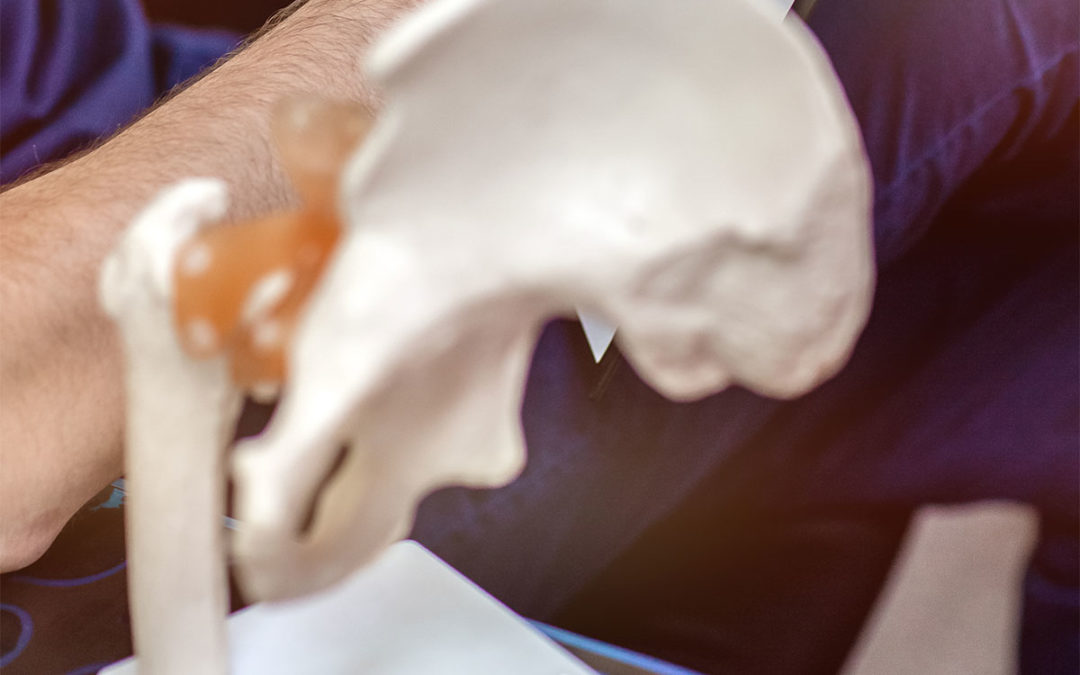 Hip Arthroscopy vs. Hip Arthroplasty