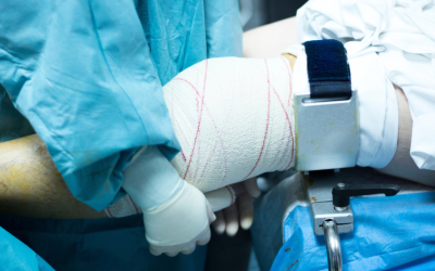 5 Do’s and Don’ts After Orthopedic Surgery