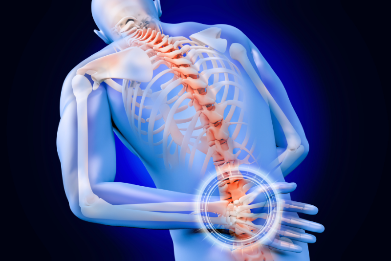 Back Pain with Leg Numbness? You Might Have Sciatica