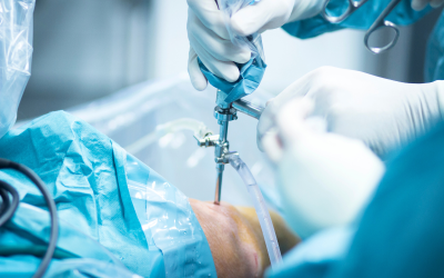 How Long Does It Take to Recover from Shoulder Surgery?