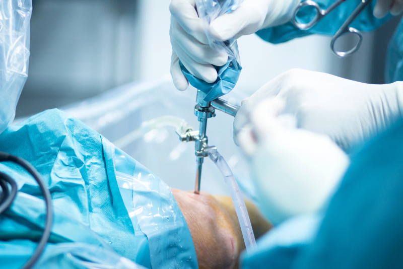 How Long Does It Take to Recover from Shoulder Surgery?