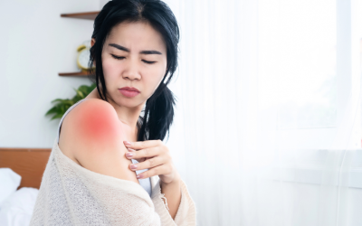 What Is a Frozen Shoulder (Adhesive Capsulitis)?