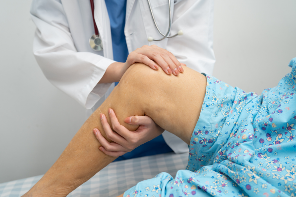 Knee Arthritis: Symptoms, Stages, and Treatment Options