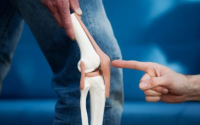 What Are the Early Signs You Might Need Joint Replacement?