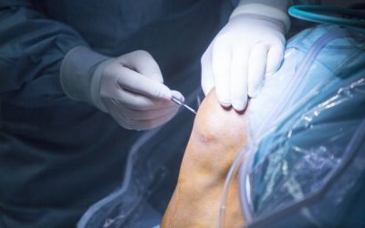 Knee Meniscus and ACL Surgery: What You Need to Know