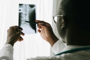 Scoliosis Treatment in Knoxville